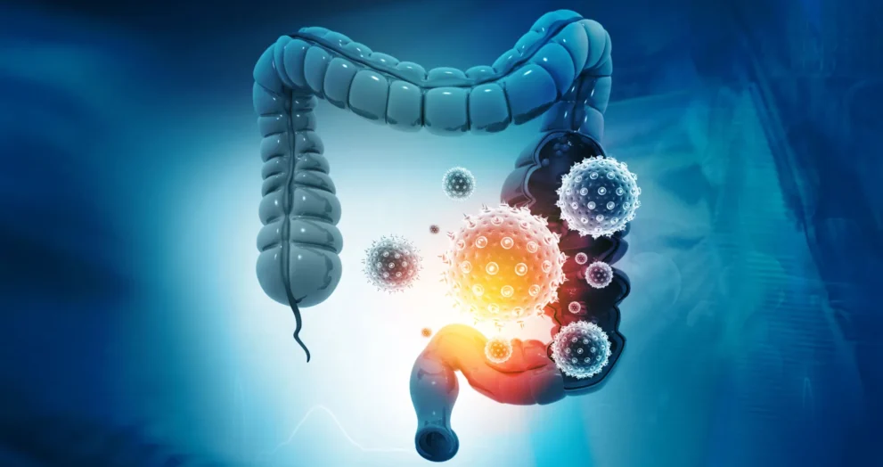 Adeus colonoscopia? Teste simples de fezes detecta 90% dos cânceres colorretais