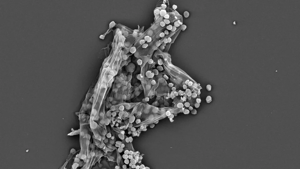 Cientistas descobrem fator oculto por trás do aumento do metano na Terra