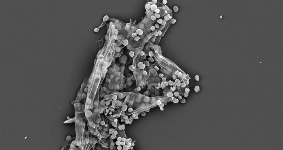 Cientistas descobrem fator oculto por trás do aumento do metano na Terra