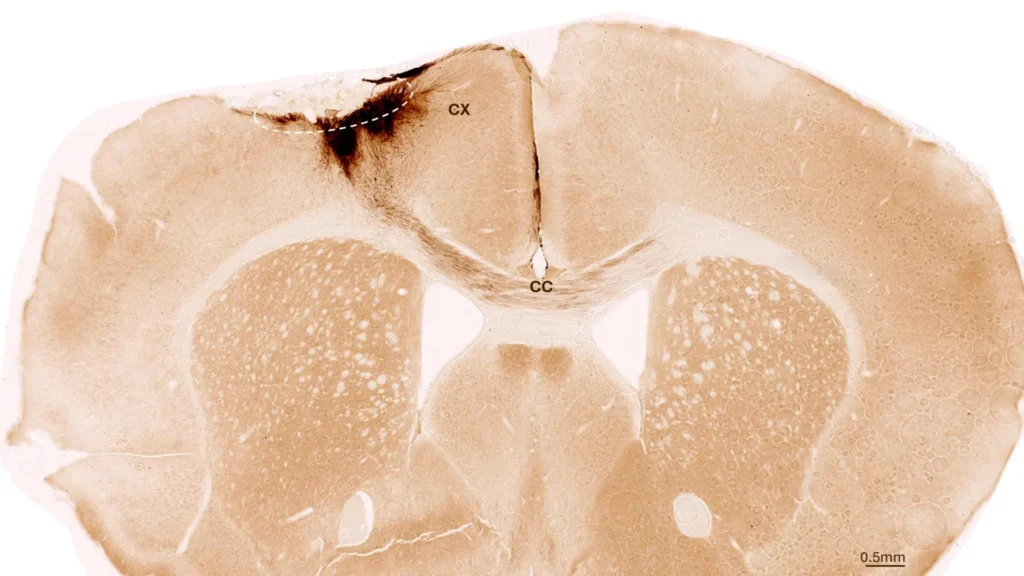 Cientistas Reparam Danos por Acidente Vascular Cerebral com Células-Tronco