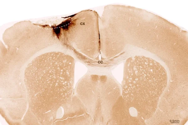 Cientistas Reparam Danos por Acidente Vascular Cerebral com Células-Tronco