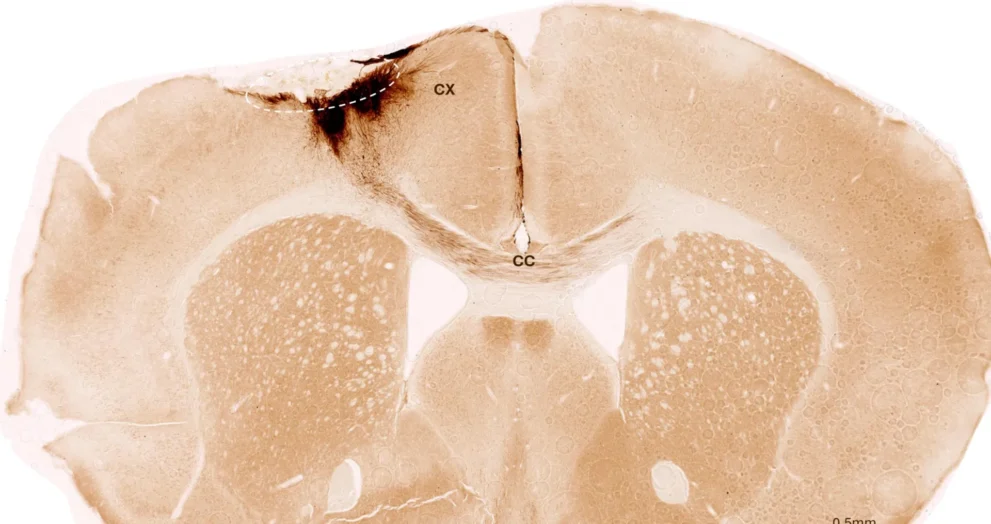 Cientistas Reparam Danos por Acidente Vascular Cerebral com Células-Tronco