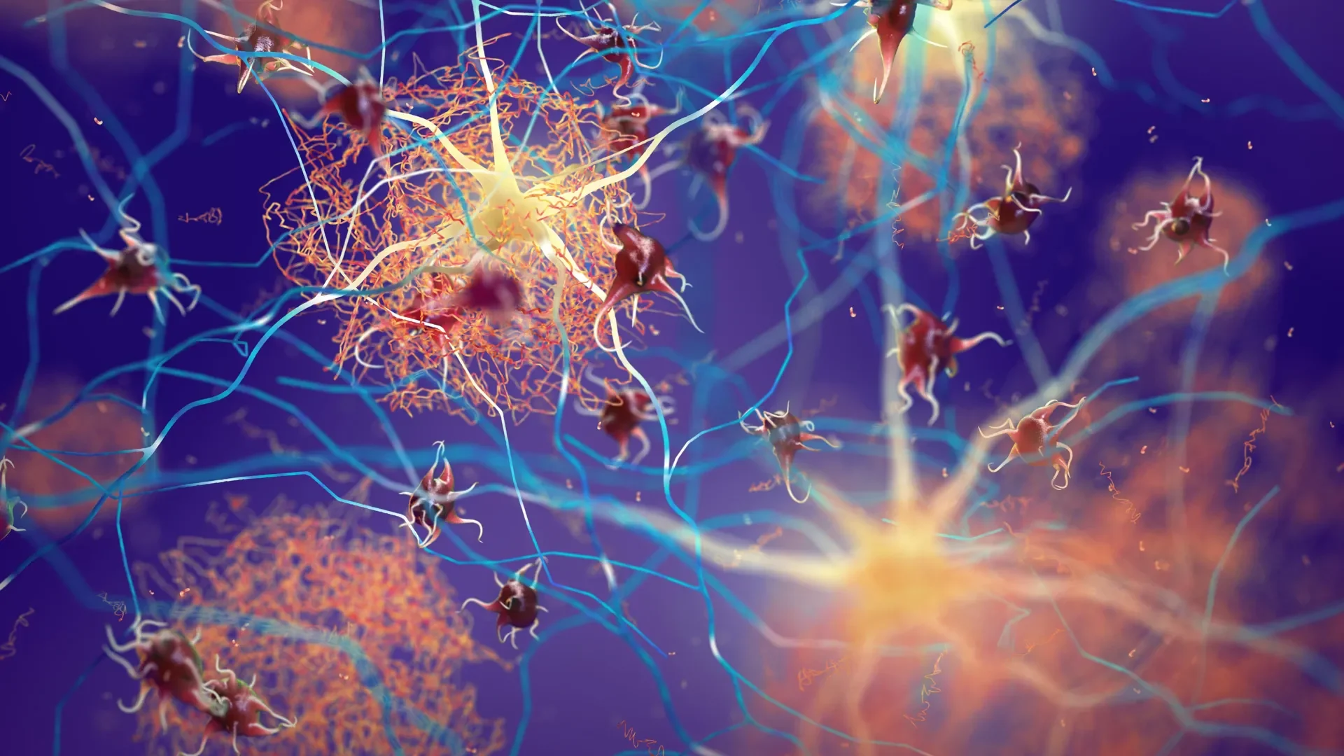 Cientistas derretem agrupamentos de proteínas precoces e interrompem danos causados pelo Alzheimer