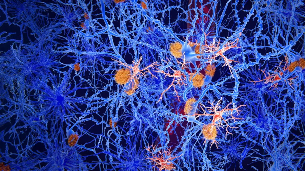 Cientistas reprogramam células imunológicas do cérebro para combater o Alzheimer